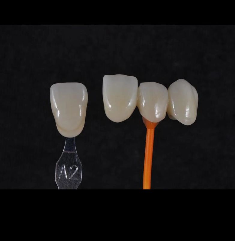3D Pro Zirconia Dental Blanc CAD CAM Bloc 98/95/92mm Système ouvert CE