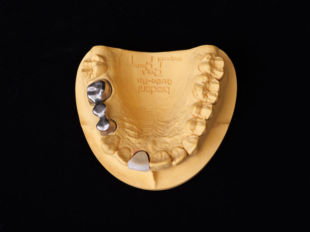 Audental 04 alliage de porcelaine noble argent-palladium alliage blanc Pd53,3% pour les restaurations dentaires durables
