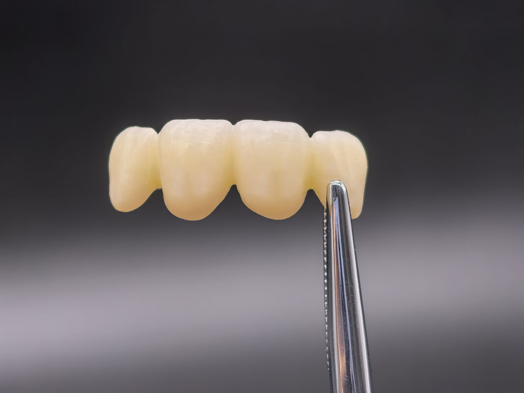 Bloc de zirconium dentaire avec des transitions d'ombre transparentes et une haute densité pour des restaurations dentaires durables et réalistes