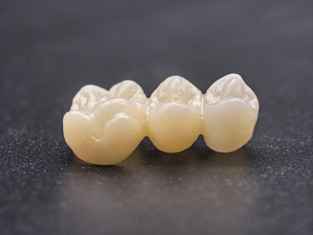 Bloc de zirconium dentaire avec des transitions d'ombre transparentes et une haute densité pour des restaurations dentaires durables et réalistes