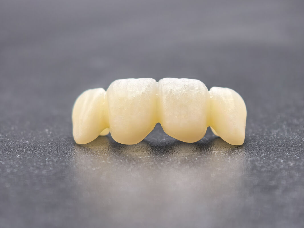 Bloc de zirconium dentaire avec des transitions d'ombre transparentes et une haute densité pour des restaurations dentaires durables et réalistes